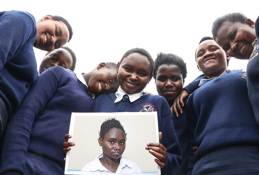Damaris, surrounded by friends in school uniforms, hold a picture of herself from before her free Smile Train-sponsored cleft surgery
