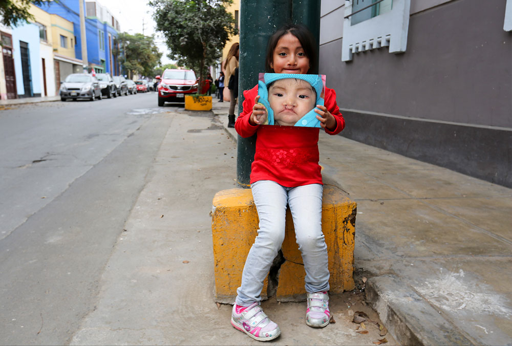Smile Train patient in Peru holding a picture of herself before free cleft surgery