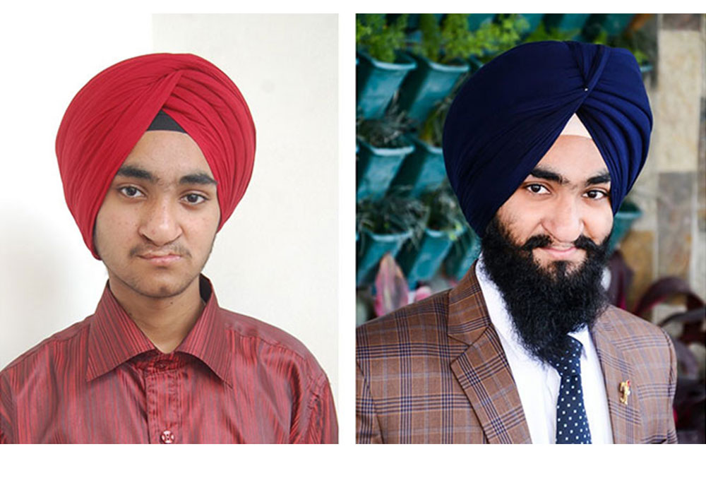 Harkirat before and after free Smile Train cleft surgery in India