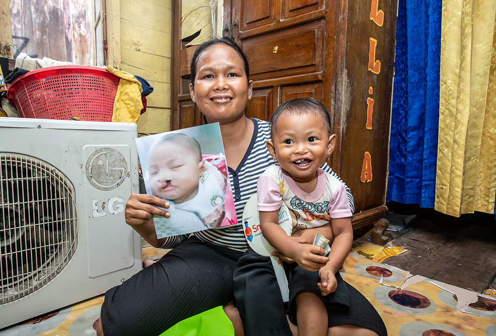 Karina being held by her mother, who is holding a picture of her before her cleft surgery