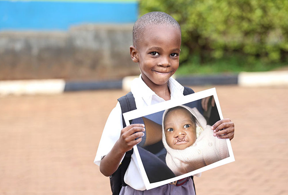 Livingstone holding a picture of himself before cleft lip and palate treatment