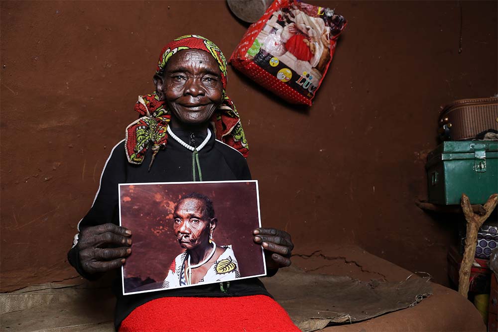 Maria holds her before cleft surgery image