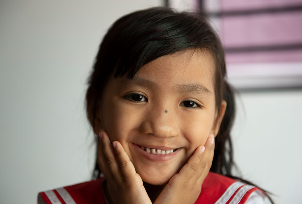 Meng smiling with her hands on her cheeks after her clef lip and palate surgery