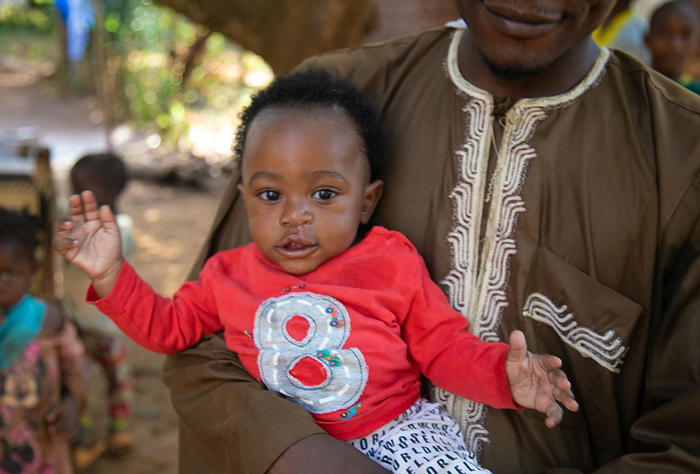 Mouhamed a few months after his free Smile Train-sponsored cleft surgery