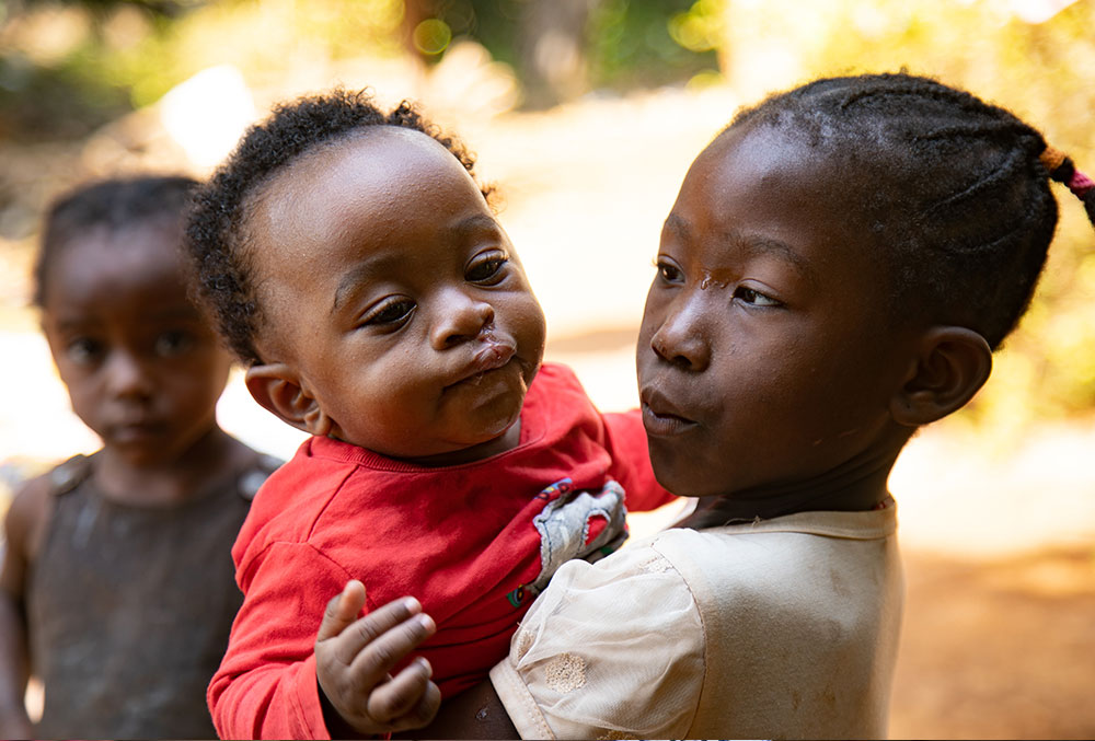 Mouhamed being held by his sisters a few months after his free Smile Train-sponsored cleft surgery