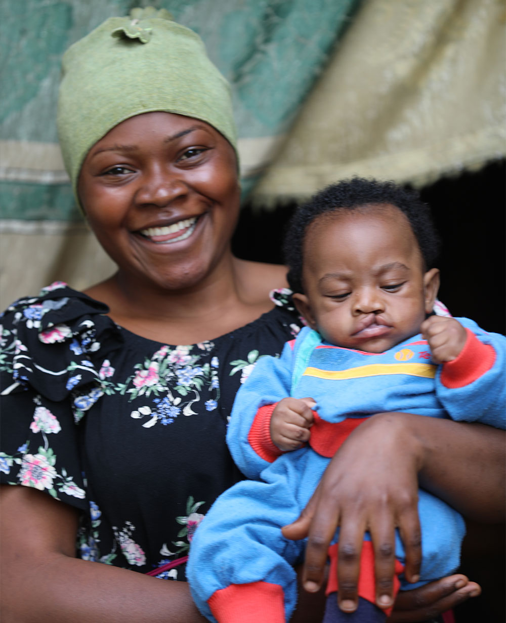 Mouhamed with his mother before his free Smile Train-sponsored cleft surgery