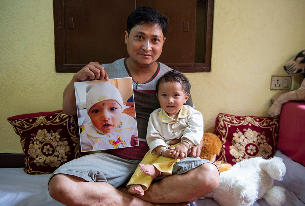 Mrighna with her father, who is holding a picture of her before her free Smile Train cleft surgery. 