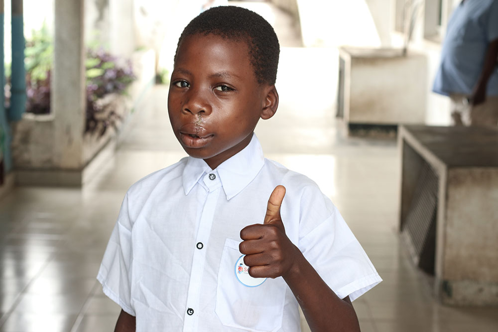Nkunda gives a thumbs up after cleft surgery