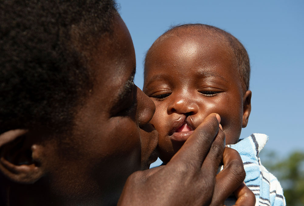 Rosemary kissing Nyasha before his cleft surgery