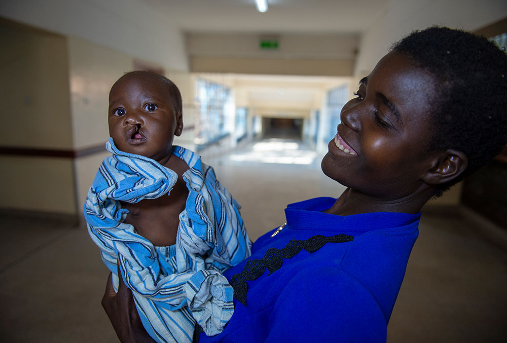 Nyasha and Rosemary in the hospital before Nyasha's free Smile Train-sponsored cleft surgery