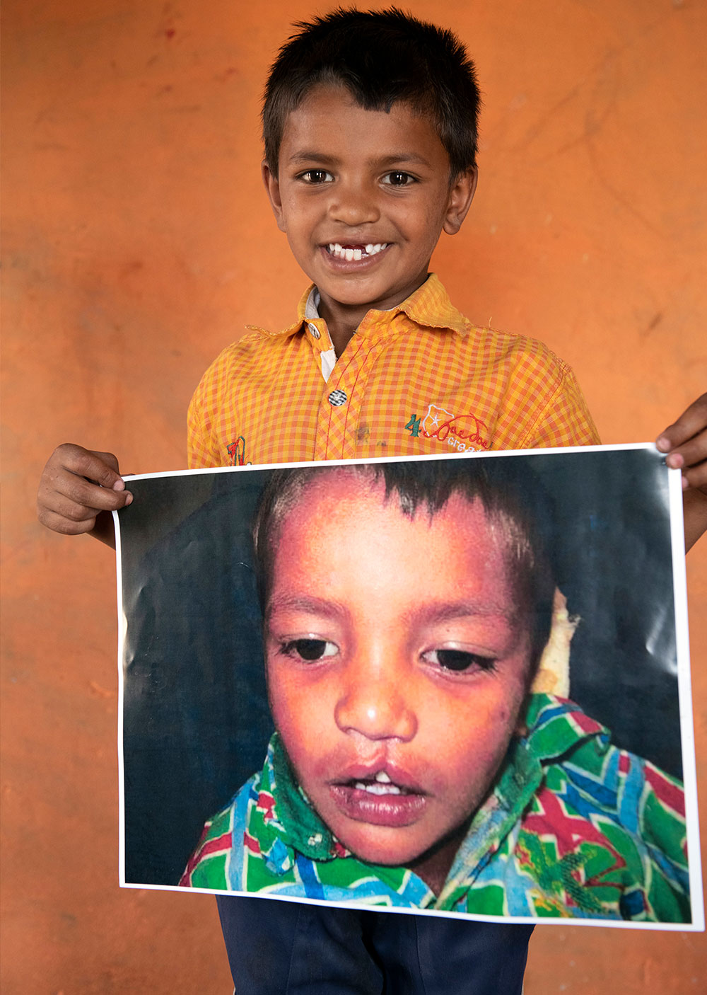 Rajesh holding a picture of himself before cleft treatment