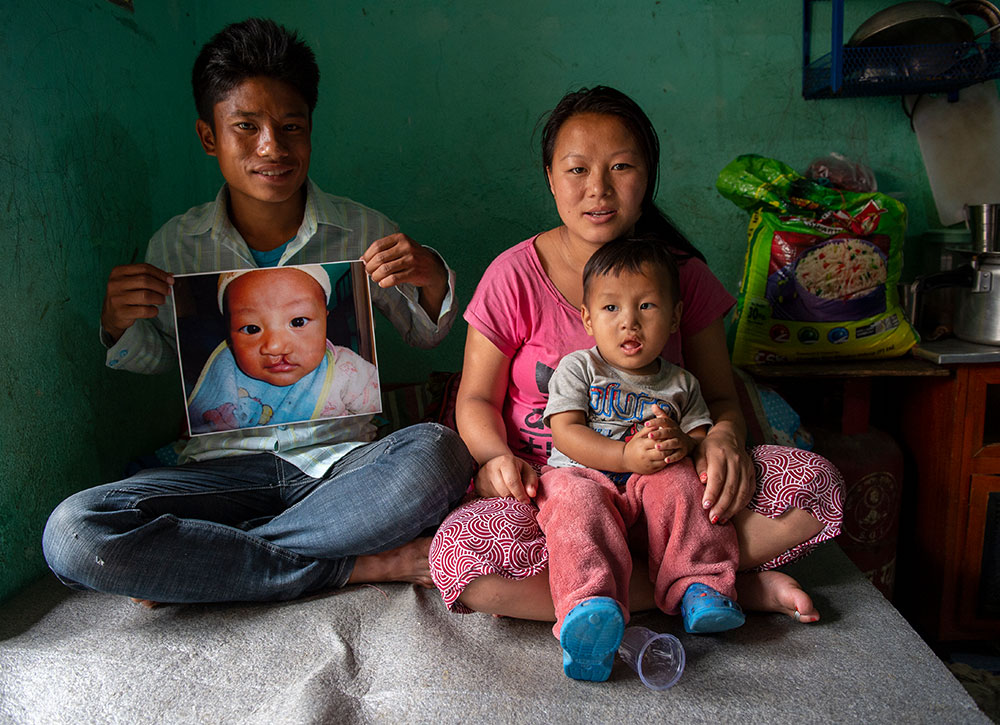Smile with his parents, who are holding a picture of him before his free Smile Train cleft surgery