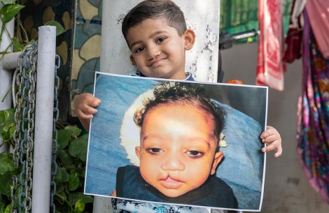 Saksham is holding an image of himself before cleft surgery