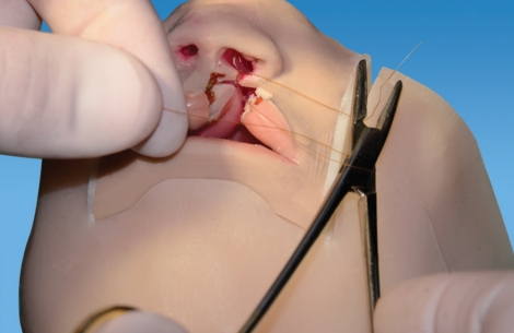 Cleft Lip Simulator