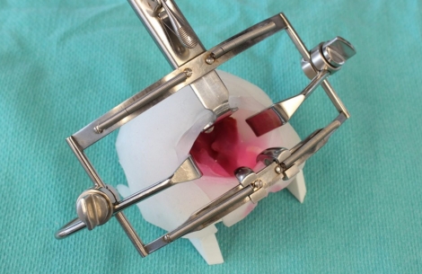 Cleft Palate Simulator