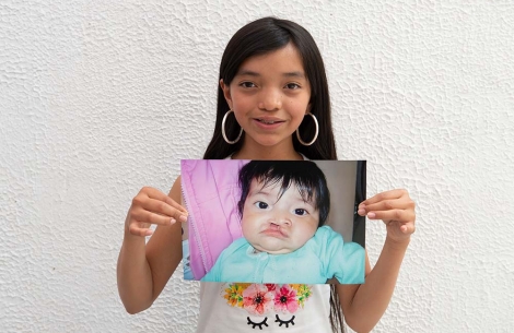 Teenager Maria holds an image of herself as a baby before her cleft surgery