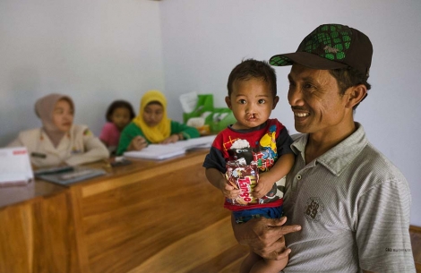 Natsir holds a child with a cleft in his arms