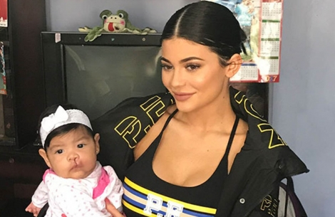 Kylie Jenner holding a baby with cleft
