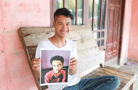 Angga holding a picture of himself before cleft surgery