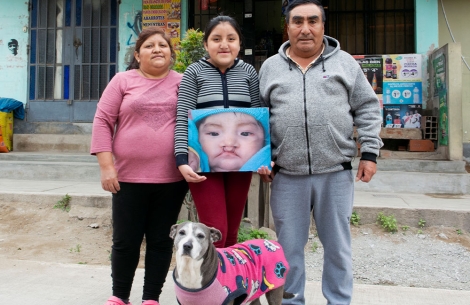 Chiara holding a picture of herself before cleft surgery and standing with her parents and dog