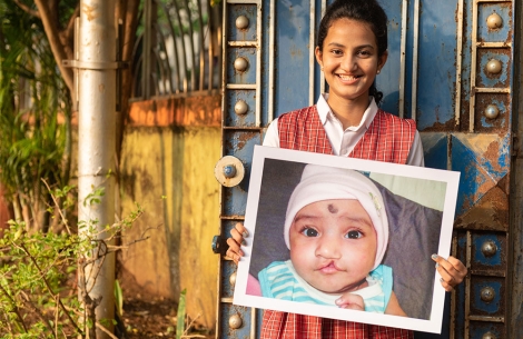 Bhargavi holding a picture of herself before cleft surgery