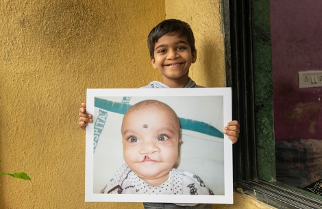 Samrat smiling with a picture of himself before cleft surgery