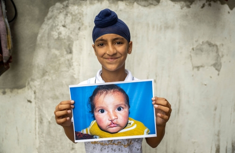 Anmolpreet smiling and holding a picture of himself as a baby before cleft surgery