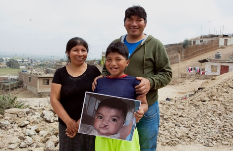 Jhon Bruce Lee smiling with his parents and holding a picture of himself before cleft surgery