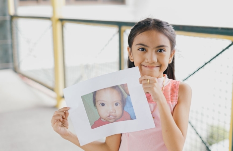 Angel smiling and holding a picture of herself before cleft surgery