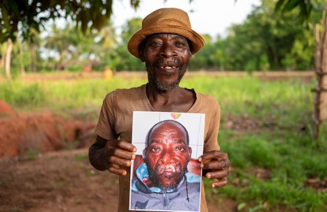 Edoh holding a picture of himself before cleft surgery