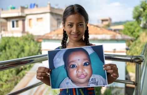 Simrik smiling and holding a picture of herself before cleft surgery