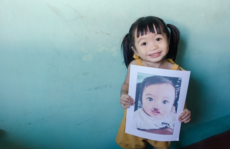 Zabriena smiling and holding a picture of herself before cleft surgery