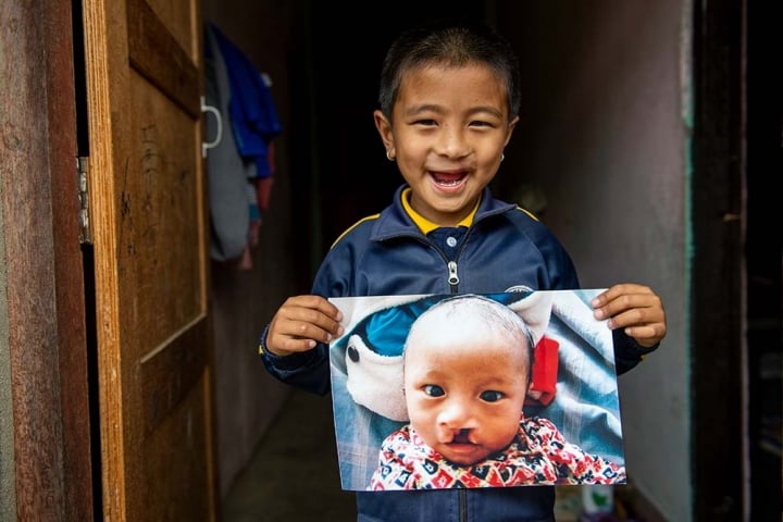 Jenious at his home holding an image of himself before cleft surgery