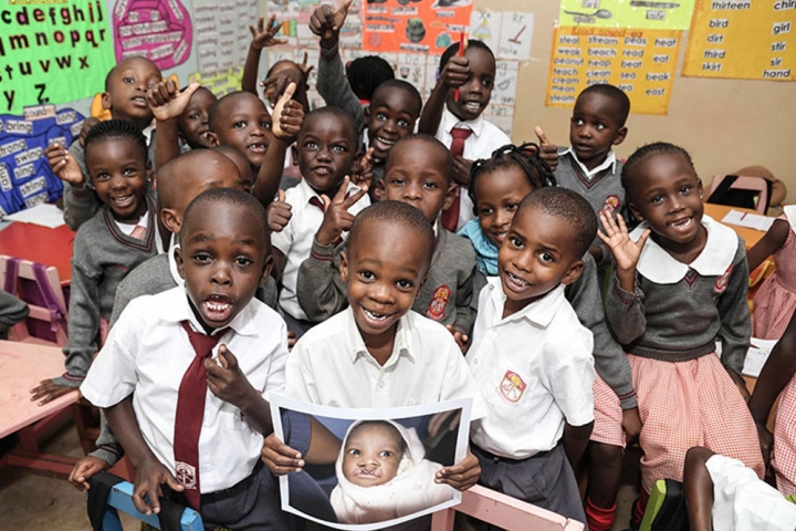 Livingstone with his friends after cleft lip and cleft palate surgery