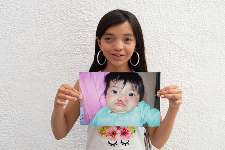 Teenager Maria holds an image of herself as a baby before her cleft surgery