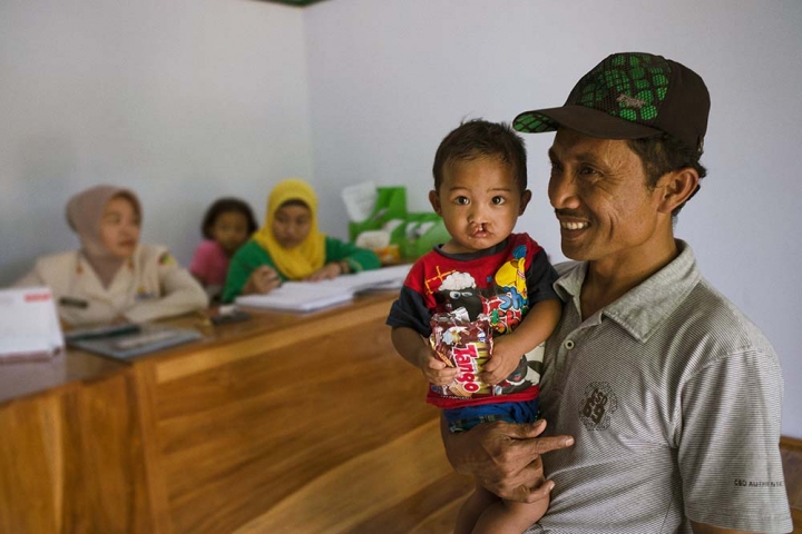 Natsir holds a child with a cleft in his arms