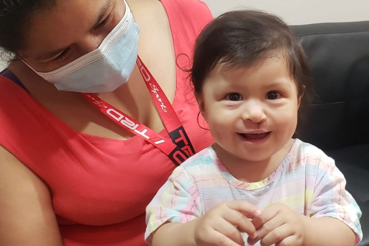 Smile Train patient Gianna after cleft lip and palate surgery