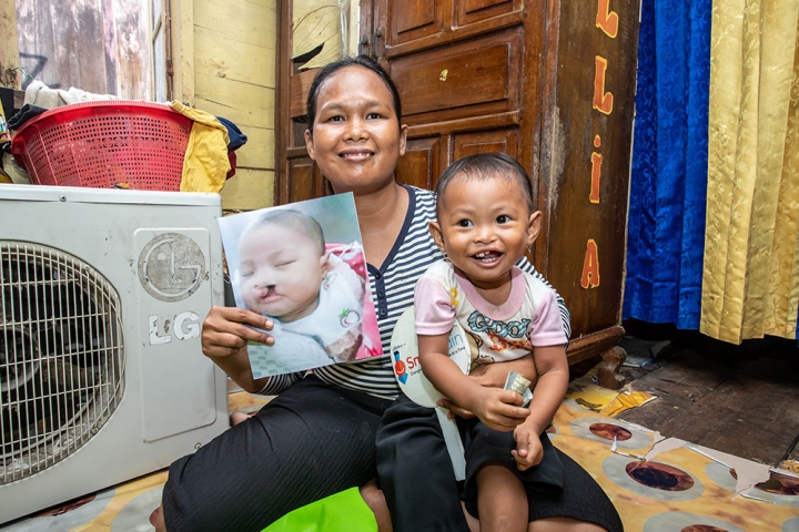 Karina and her mother, who holds a picture of her before her cleft surgery.