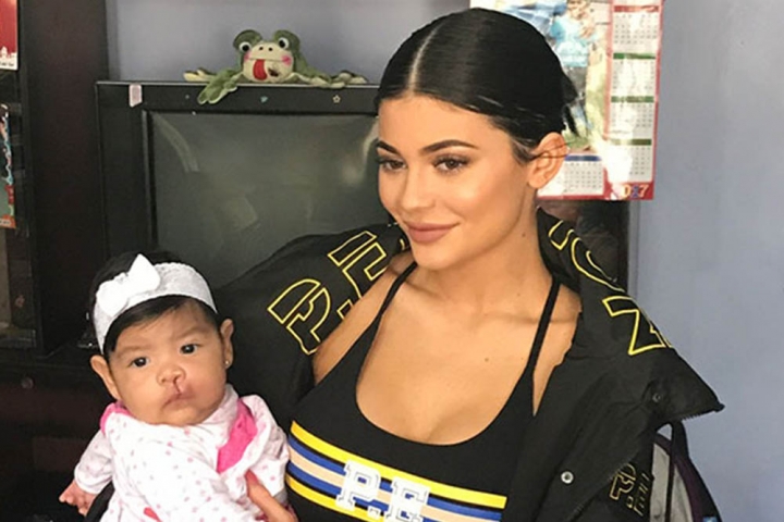 Kylie Jenner holding a baby with cleft