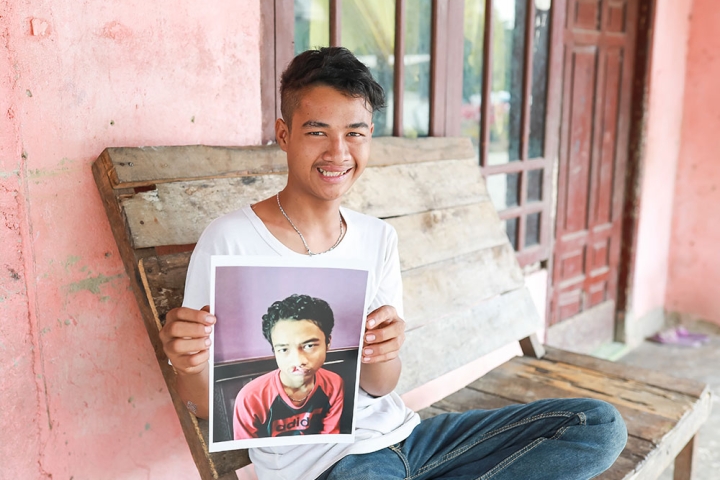 Angga holding a picture of himself before cleft surgery