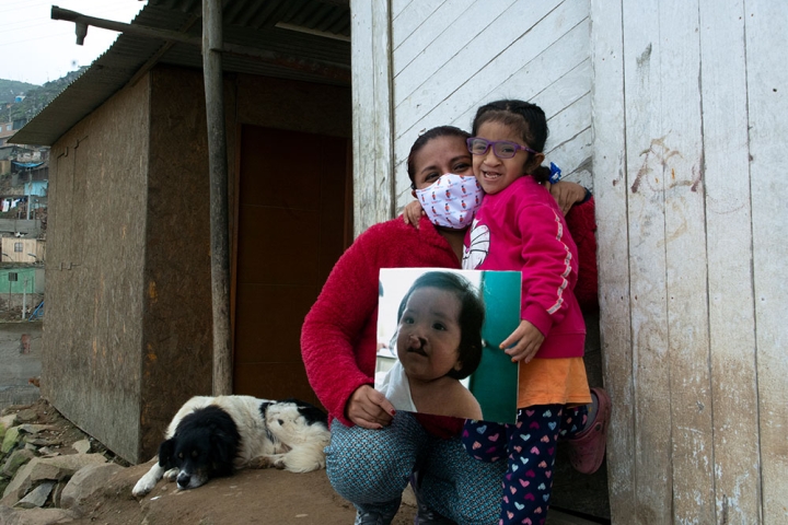 Kristhell and her mother, Cinthya, hold a picture of Kristhell before Smile Train cleft surgery 