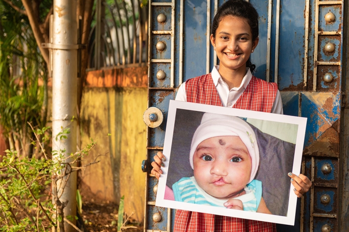Bhargavi holding a picture of herself before cleft surgery