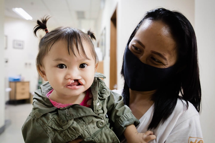 CURE and Smile Train Patient