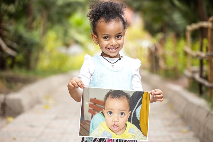 Makiba holding a picture of herself before cleft surgery