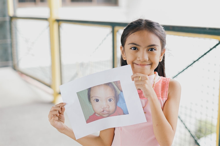 Angel smiling and holding a picture of herself before cleft surgery