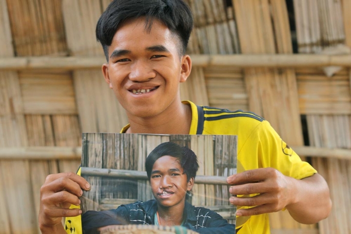 Ray holding a photo of himself before cleft surgery