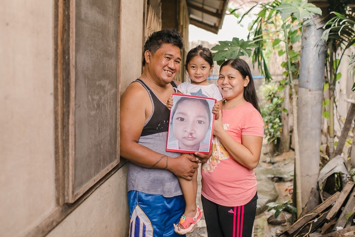 Savannah being held by her parents while holding a picture of herself before cleft lip and palate surgery. Everybody is smiling