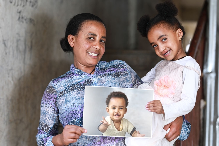 Zinash holding Marsillas and a picture of her before her cleft surgery. Both are smiling