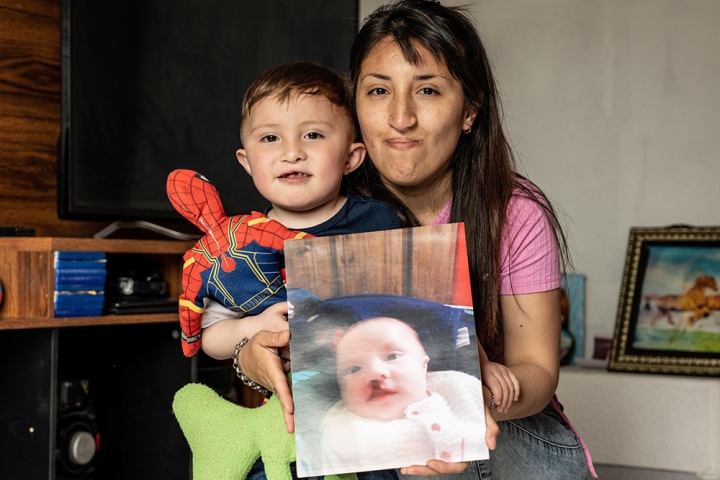 Andrea holding Edden and a picture of him before cleft surgery