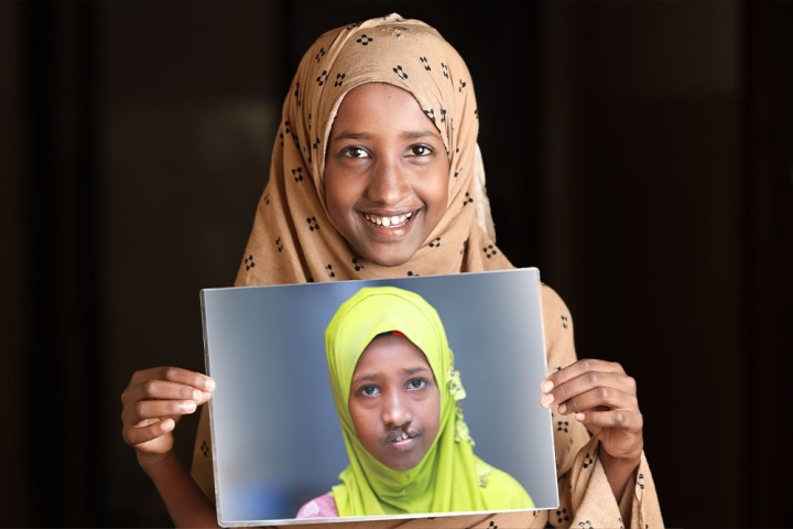 A smiling Maryan holds up a photo of herself from before cleft treatment